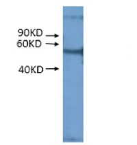 RPS2 | Ribosomal protein S2 (mitochondrial) in the group Antibodies for Plant/Algal / DNA/RNA/Cell Cycle / Translation at Agrisera AB (Antibodies for research) (AS16 3832)